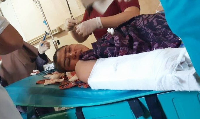 Tanpa Alasan, Suami Tega Bacok Istri di Kecamatan Liang